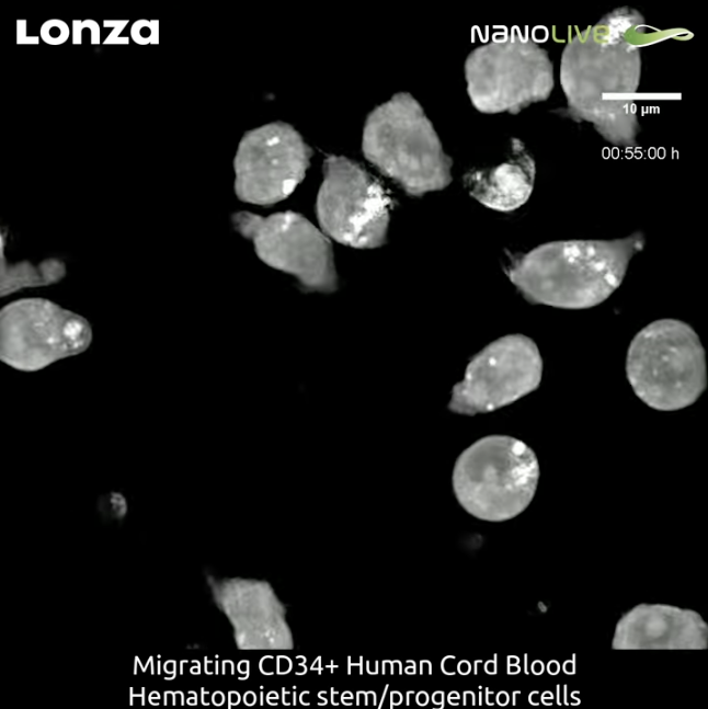 Screenshot of video showing migrating CD34+ cells